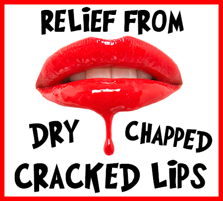 Urbandale dentist, Dr. Stefanie Donnell-Randall at The Dental Loft, tells you how to relieve your dry, chapped, and cracked lips!