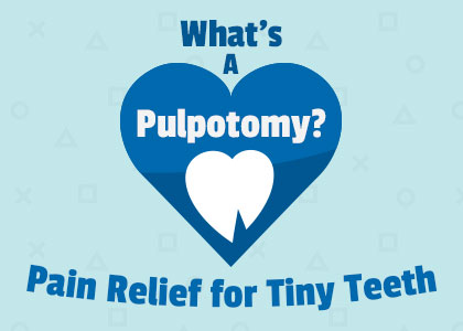Urbandale dentist, Dr. Stefanie Donnell-Randall of The Dental Loft, explains what a pulpotomy is, when they’re recommended, and the steps of the procedure for saving baby teeth.