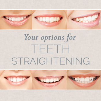 Urbandale dentist, Dr. Stefanie Donnell-Randall at The Dental Loft shares all you need to know about choosing the right teeth straightening option for you.