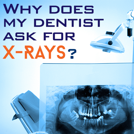 Urbandale dentist, Dr. Stefanie Donnell-Randall at The Dental Loft, discusses the importance of dental x-rays for accurate diagnosis and treatment planning.